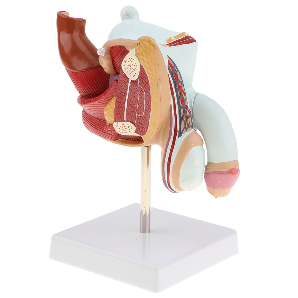 1:1 Human Male Reproduction Urinary System Pathlology Model Gonorrhea Ureteral Calculus Display Medical Study Lab Supplies
1:1 Human Male Reproduction Urinary System Pathlology Model Gonorrhea Ureteral Calculus Display Medical Study Lab Supplies