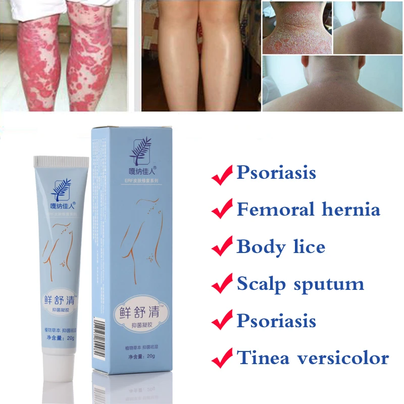 29A Natural Cream Works Really Well For Psoriasi Eczma Skin CARE with gift (omly for 11.11)
29A Natural Cream Works Really Well For Psoriasi Eczma Skin CARE with gift (omly for 11.11)