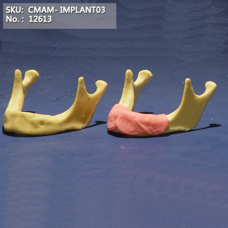 12613/ Toothless jaw, implant practice/CMAM, Human Oral Dental Medical Teaching Anatomical Model
12613/ Toothless jaw, implant practice/CMAM, Human Oral Dental Medical Teaching Anatomical Model