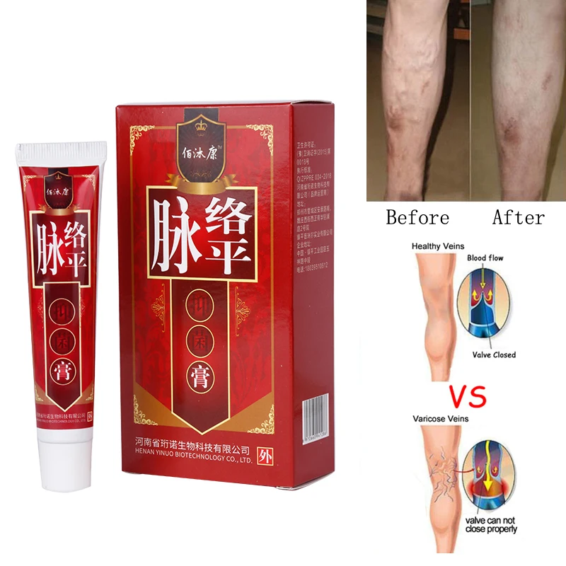 Varicose Veins Treatment Cream Ointment Vasculitis Phlebitis Spider Veins Pain Varicosity Angiitis Remedy Removal Herbal Cream
Varicose Veins Treatment Cream Ointment Vasculitis Phlebitis Spider Veins Pain Varicosity Angiitis Remedy Removal Herbal Cream