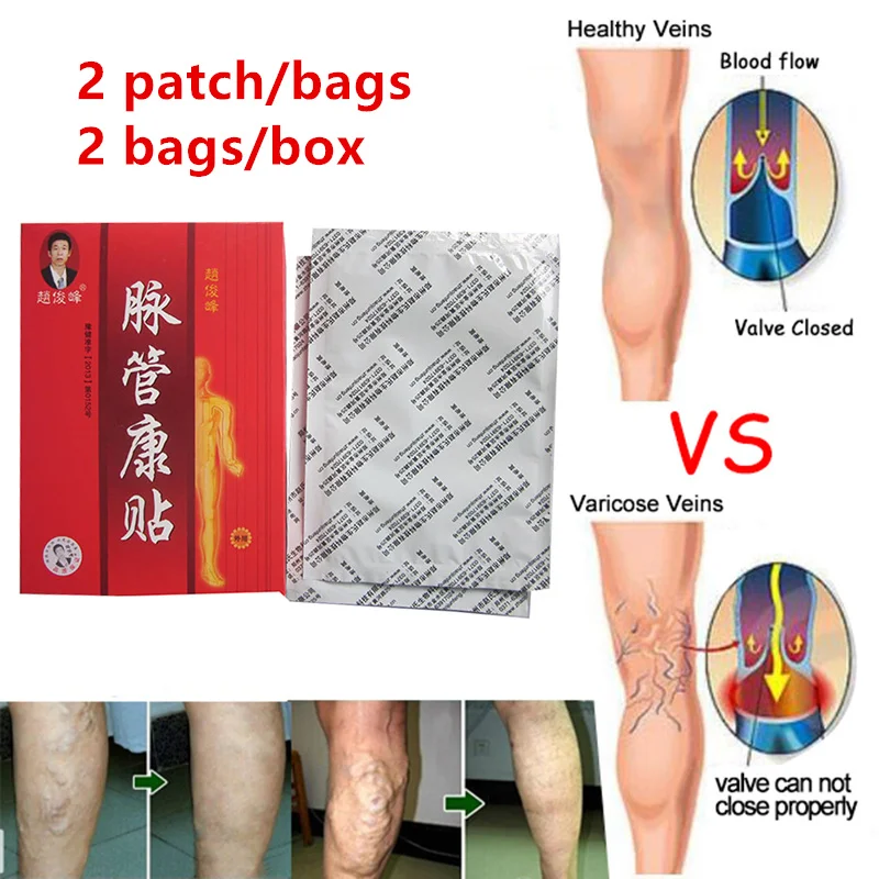 Spider Veins Varicose Treatment Plaster Varicose Veins Cure Patch Vasculitis Natural Solution Herbal Plaster Patches
Spider Veins Varicose Treatment Plaster Varicose Veins Cure Patch Vasculitis Natural Solution Herbal Plaster Patches