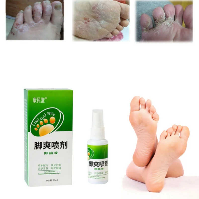30ml Plant Spray Feet Care Remove Odor Sweat Feet Treatment Wholesale Natural Practical Foot Care Products
30ml Plant Spray Feet Care Remove Odor Sweat Feet Treatment Wholesale Natural Practical Foot Care Products