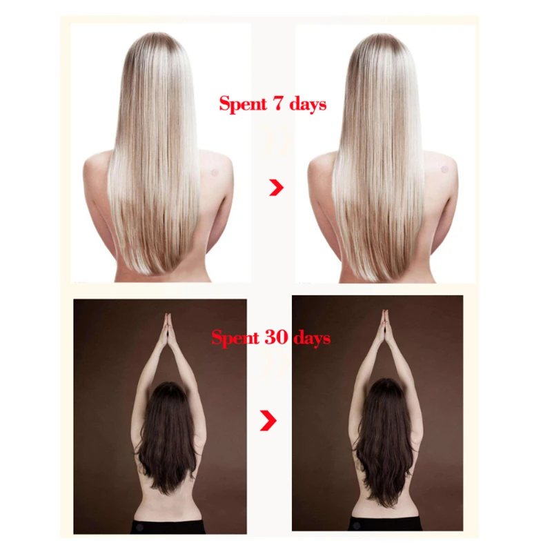 Hair Care Fast Powerful Hair Growth Garlic Essential Oil Regrowth Essence Oil Treatment Preventing Hair Loss Fast Effective
Hair Care Fast Powerful Hair Growth Garlic Essential Oil Regrowth Essence Oil Treatment Preventing Hair Loss Fast Effective