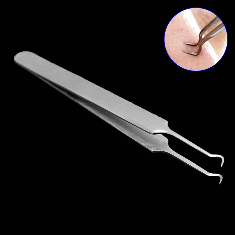 Newly Stainless Steel Blackhead Remover Needle Clip Kit Blemish Acne Pimple Extractor Tool Facial Cleaning Acne Removal Needle
Newly Stainless Steel Blackhead Remover Needle Clip Kit Blemish Acne Pimple Extractor Tool Facial Cleaning Acne Removal Needle