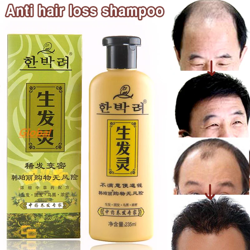 Hair Loss Products shampoo Morocco nut oils hair care argan nut oil Hair Conditioner prevention special offers Scalp hair care
Hair Loss Products shampoo Morocco nut oils hair care argan nut oil Hair Conditioner prevention special offers Scalp hair care