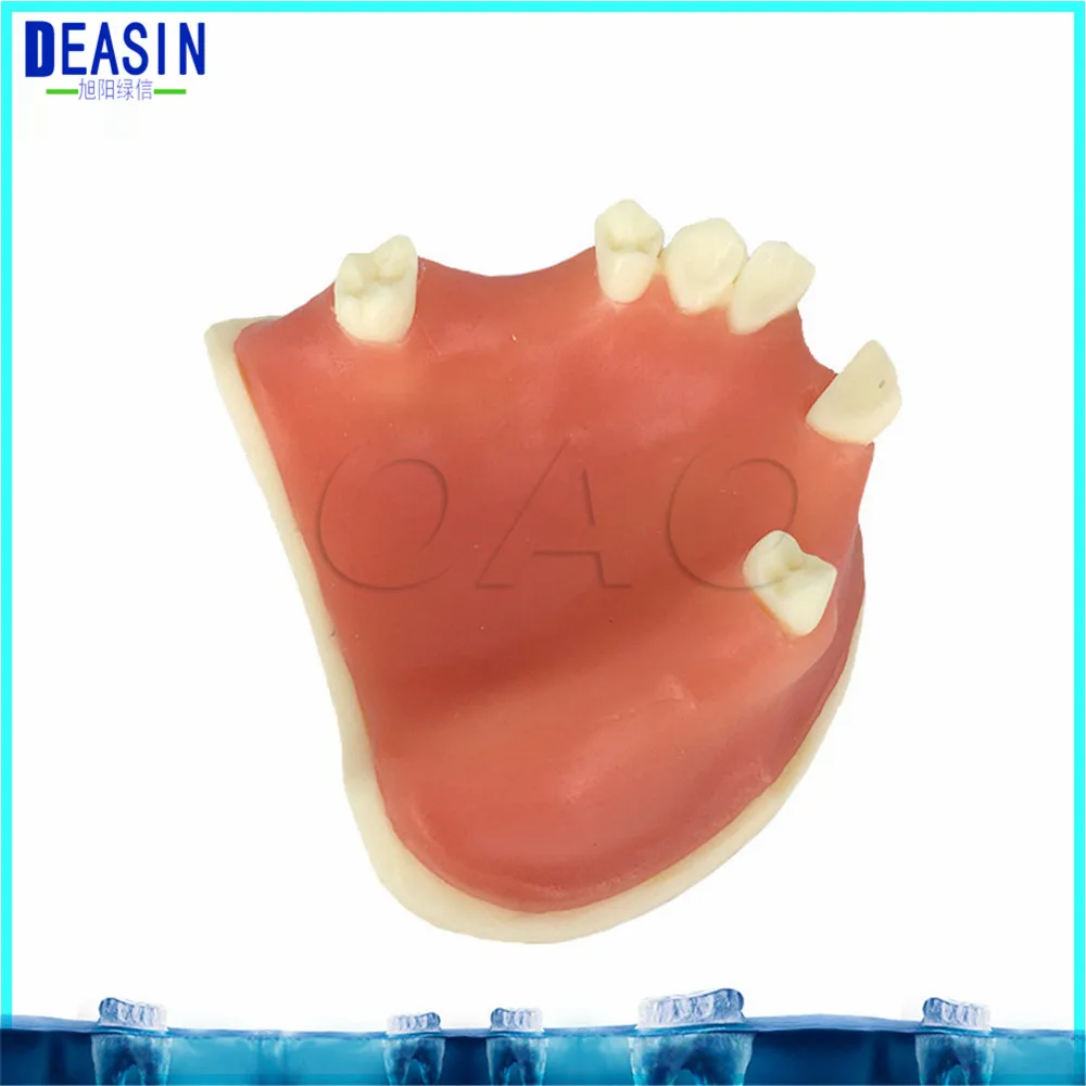 High Quality Implant practice model for teaching dental tooth teeth dentist anatomical anatomy model odontologia
High Quality Implant practice model for teaching dental tooth teeth dentist anatomical anatomy model odontologia
