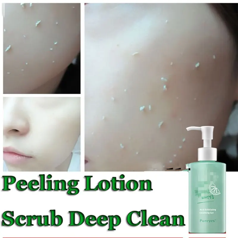 new Face Care Beauty Acid Peeling Gel Exfoliating Scale Cream Facial Deep Remover Face Cleanser Skin Care Cosmetics
new Face Care Beauty Acid Peeling Gel Exfoliating Scale Cream Facial Deep Remover Face Cleanser Skin Care Cosmetics