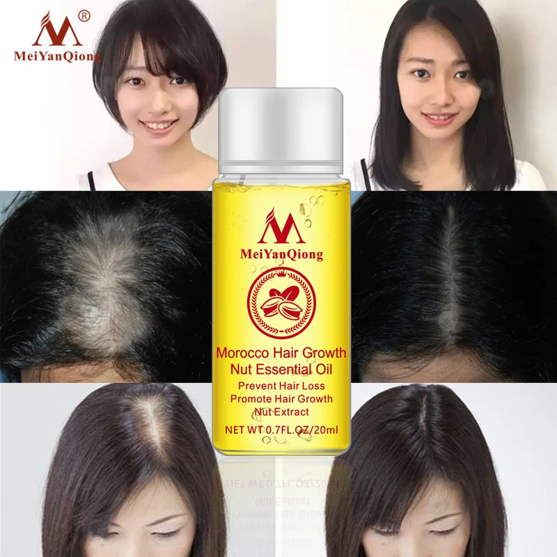 MeiYanQiong Herbal Hair Growth Treatment Thick Hair Growth Essential Oil Anti-Hair Loss Promote Hair Growth For Women And Men
MeiYanQiong Herbal Hair Growth Treatment Thick Hair Growth Essential Oil Anti-Hair Loss Promote Hair Growth For Women And Men