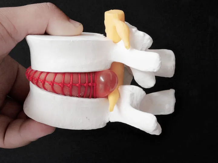 Decoration Crafts Figurines Human Lumbar Disc Herniation Model Demonstration Model of Lumbar Vertebral Spine Model
Decoration Crafts Figurines Human Lumbar Disc Herniation Model Demonstration Model of Lumbar Vertebral Spine Model