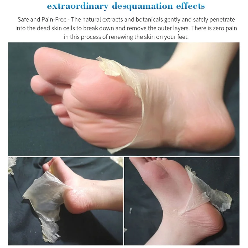 High Quality 3Pairs Peeling Foot Mask Exfoliating Scrub Pedicure Spa Foot Peel Heels Moisture Feet Care Accessories NShopping
High Quality 3Pairs Peeling Foot Mask Exfoliating Scrub Pedicure Spa Foot Peel Heels Moisture Feet Care Accessories NShopping