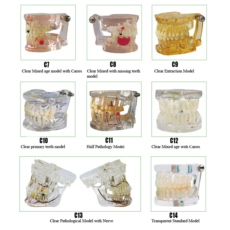 Dental Pathology Model Clear primary teeth model dental Extraction Model for Standard Model
Dental Pathology Model Clear primary teeth model dental Extraction Model for Standard Model