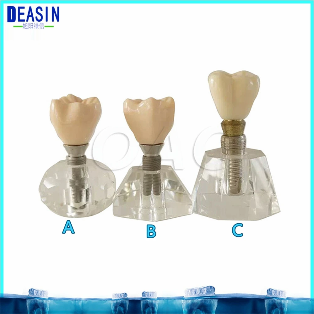Dental teeth model Crystal Base Hard Plastic Teeth Dental Implant Practice Model MACRO IMPLANT MODEL CROWN BRIDGE
Dental teeth model Crystal Base Hard Plastic Teeth Dental Implant Practice Model MACRO IMPLANT MODEL CROWN BRIDGE