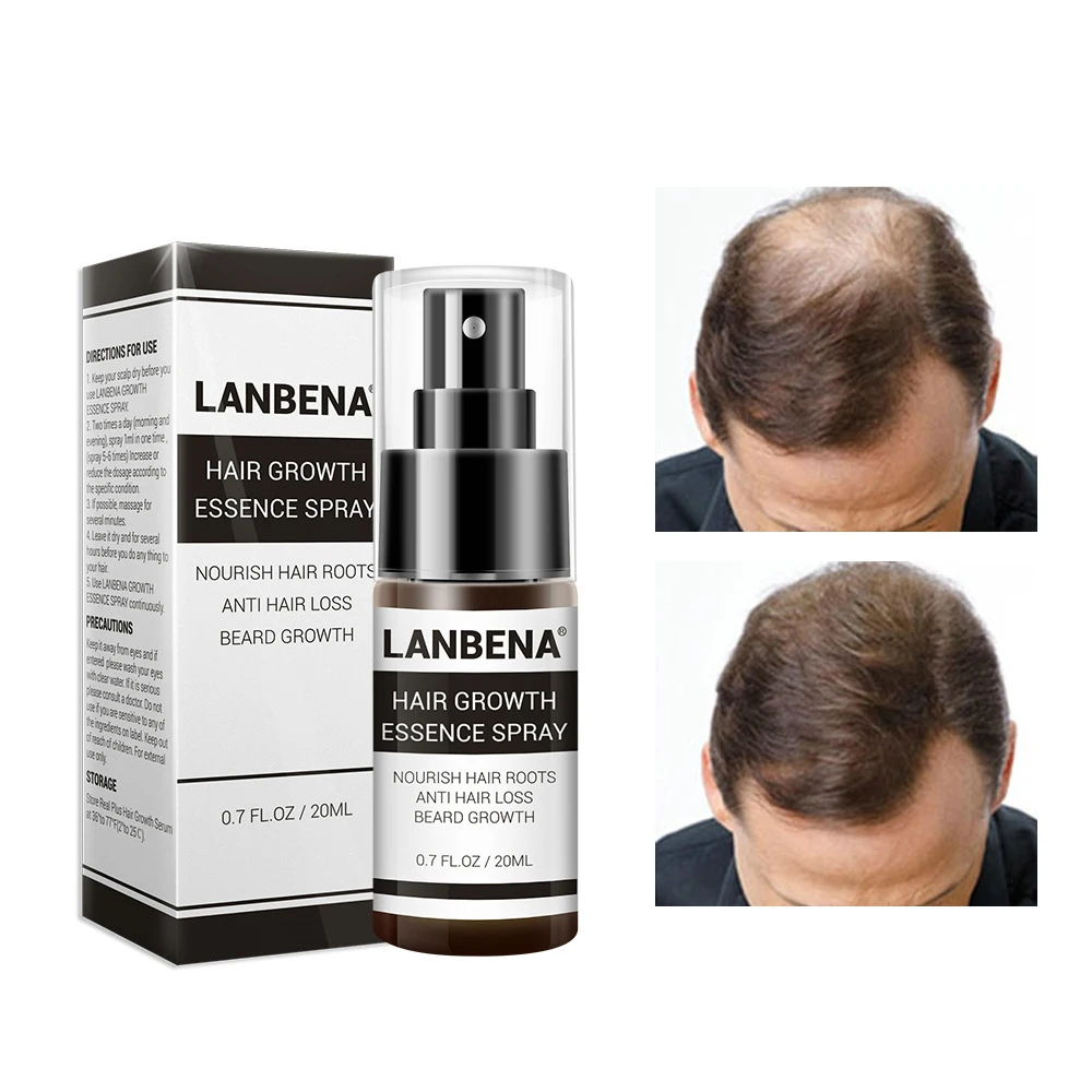 3 pcs Hair Growth Essence Spray 20ML Anti Hair Loss Nourish Roots Hair Essence Care Supplies New Arrive 2019
3 pcs Hair Growth Essence Spray 20ML Anti Hair Loss Nourish Roots Hair Essence Care Supplies New Arrive 2019