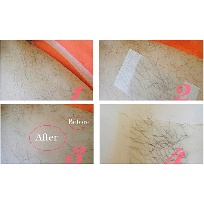 5pcs/pack Double Side Hair Removal Cold Wax Strips Paper For Leg Body Facial Hair Removal Wax Strips Professional
5pcs/pack Double Side Hair Removal Cold Wax Strips Paper For Leg Body Facial Hair Removal Wax Strips Professional