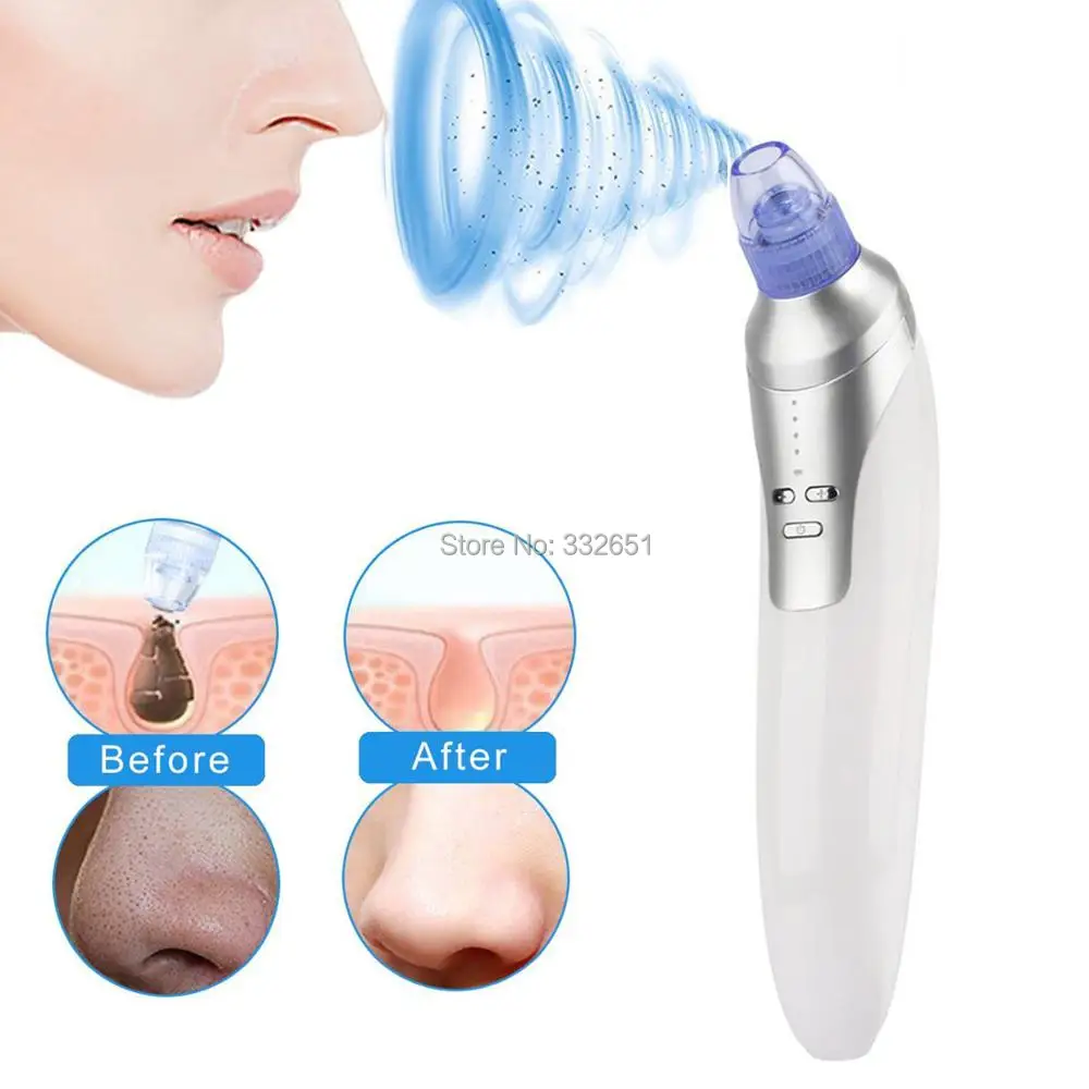 Electric Blackhead Remover - Rechargeable Facial Pore Cleanser Microdermabrasion Vacuum Suction Machine Comedone Acne Extractor
Electric Blackhead Remover - Rechargeable Facial Pore Cleanser Microdermabrasion Vacuum Suction Machine Comedone Acne Extractor