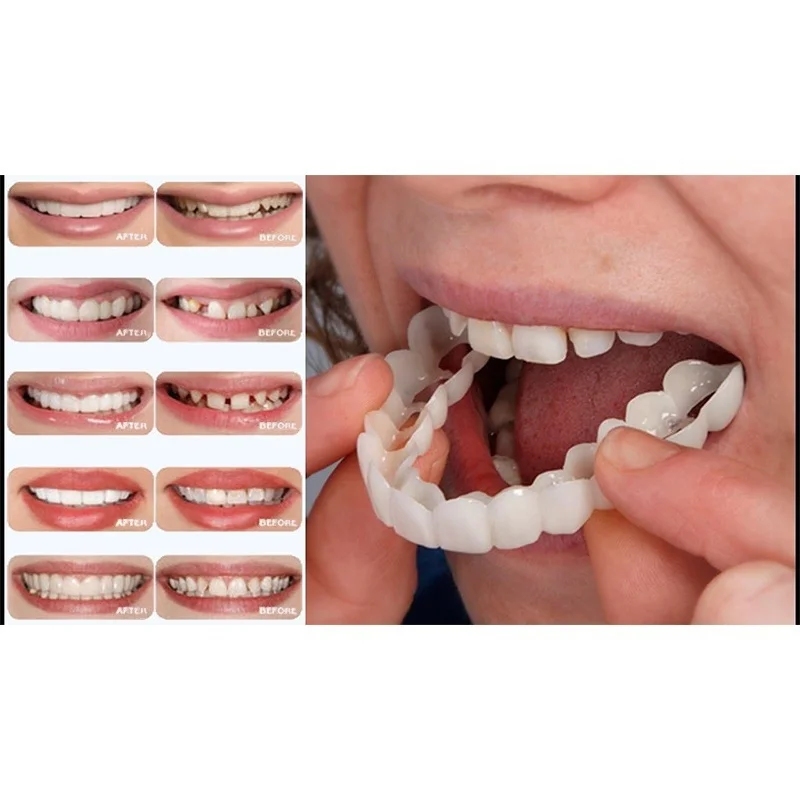 Подтяжки для зубов отбеливающие с улыбкой 2021 | Красота и здоровье