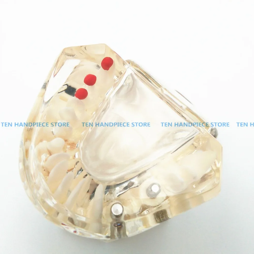 2018 good quality Dental implant Demonstration Bracket Simulation Caries Teeth Model teeth removable Dentist
2018 good quality Dental implant Demonstration Bracket Simulation Caries Teeth Model teeth removable Dentist