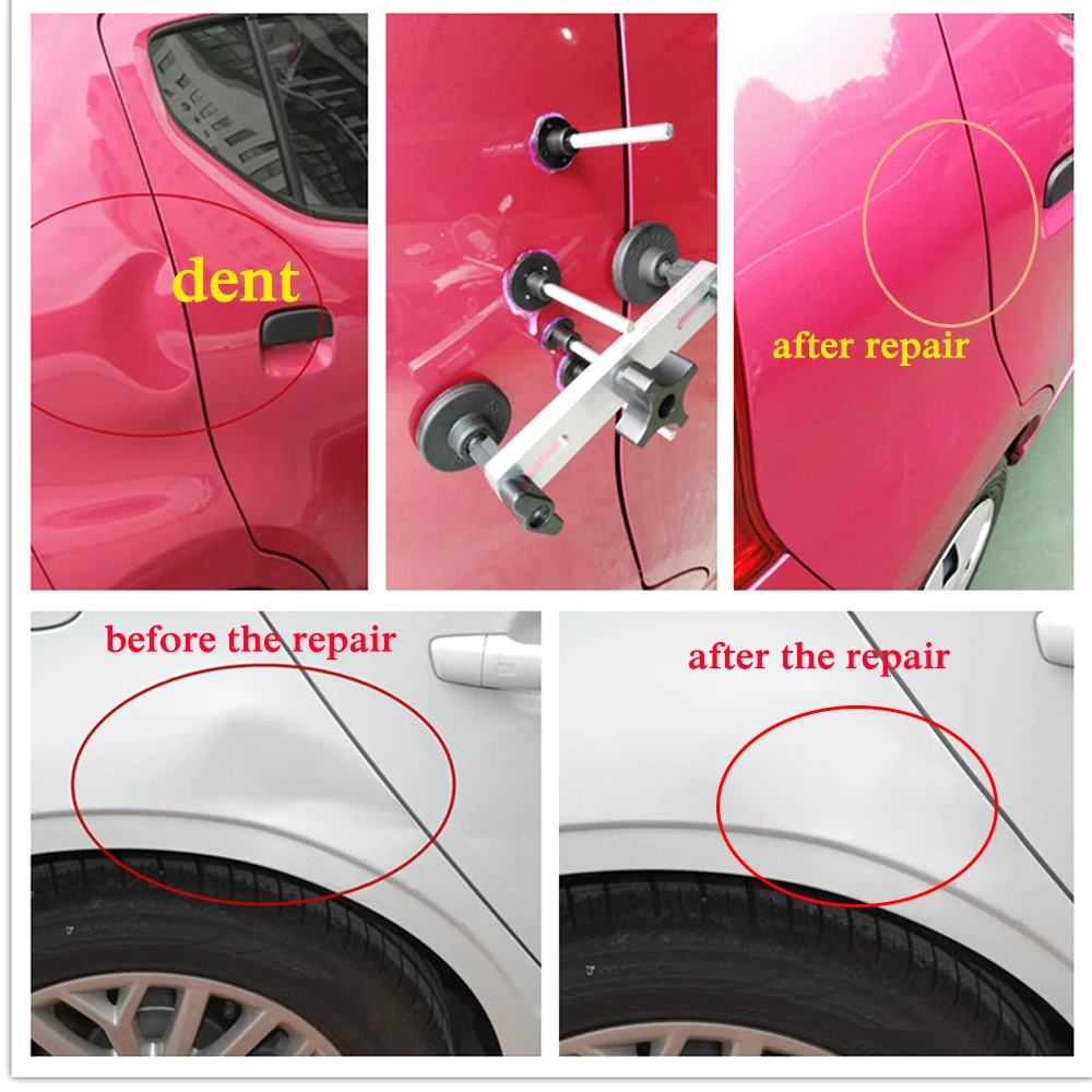 Super PDR Car Dent Removal Body Repair Artifact Kit Repair-free Multi-function Tool Dedicated Pull Dent Ferramentas
Super PDR Car Dent Removal Body Repair Artifact Kit Repair-free Multi-function Tool Dedicated Pull Dent Ferramentas