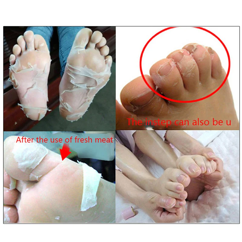 High Quality 3Pairs Peeling Foot Mask Exfoliating Scrub Pedicure Spa Foot Peel Heels Moisture Feet Care Accessories SMJ
High Quality 3Pairs Peeling Foot Mask Exfoliating Scrub Pedicure Spa Foot Peel Heels Moisture Feet Care Accessories SMJ