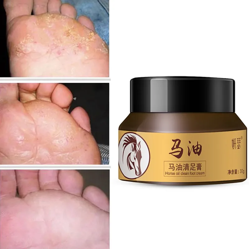 Horse Oil Foot Cream Care Beriberi Cream Feet Itch Blisters Anti-chapping Peeling Beriberi Bad Feet Ointment Treatment Care
Horse Oil Foot Cream Care Beriberi Cream Feet Itch Blisters Anti-chapping Peeling Beriberi Bad Feet Ointment Treatment Care