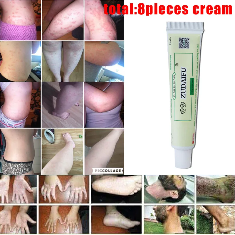 8pcs/lot zudaifu body cream without retail box men women skin care product relieve Psoriasis Dermatitis Eczema Pruritus effect
8pcs/lot zudaifu body cream without retail box men women skin care product relieve Psoriasis Dermatitis Eczema Pruritus effect
