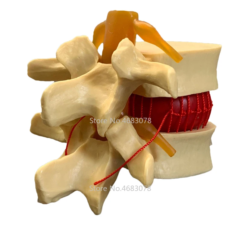 1:1 Human anatomy skeleton Spine Lumbar Disc Herniation Teaching Model brain skull traumatic pistol school medical supplies
1:1 Human anatomy skeleton Spine Lumbar Disc Herniation Teaching Model brain skull traumatic pistol school medical supplies