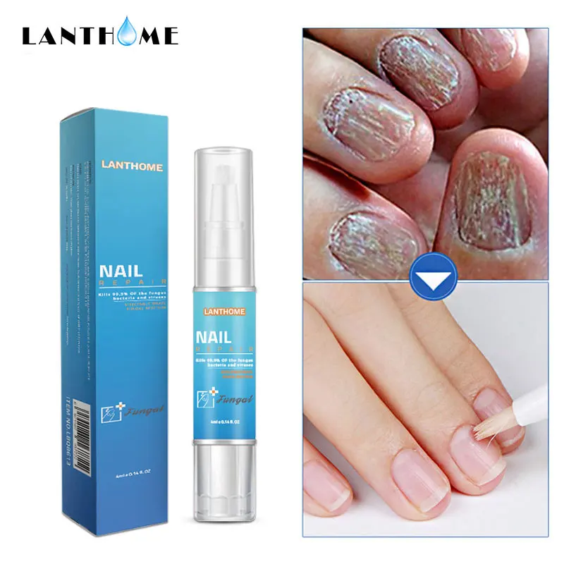 Powerful Nail Treatment Pen Onychomycosis Paronychia Anti Fungal Nail Infection Toe Fungus Chinese Herbal Care Repair Serum Tool
Powerful Nail Treatment Pen Onychomycosis Paronychia Anti Fungal Nail Infection Toe Fungus Chinese Herbal Care Repair Serum Tool