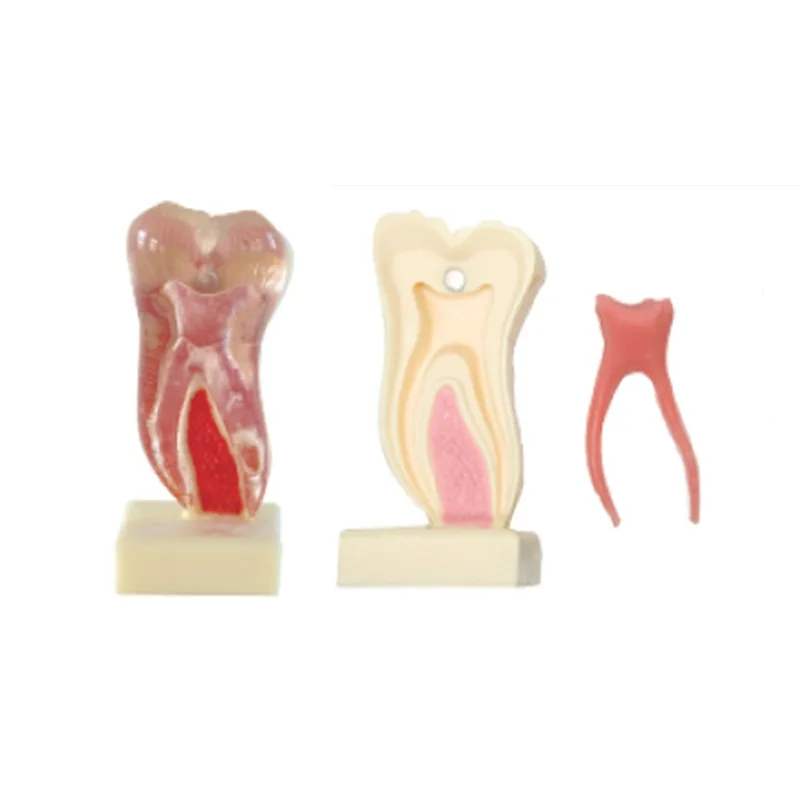6 Times Anatomic Profile Model of Mandibular Molar for Teeth Studay and Education
6 Times Anatomic Profile Model of Mandibular Molar for Teeth Studay and Education