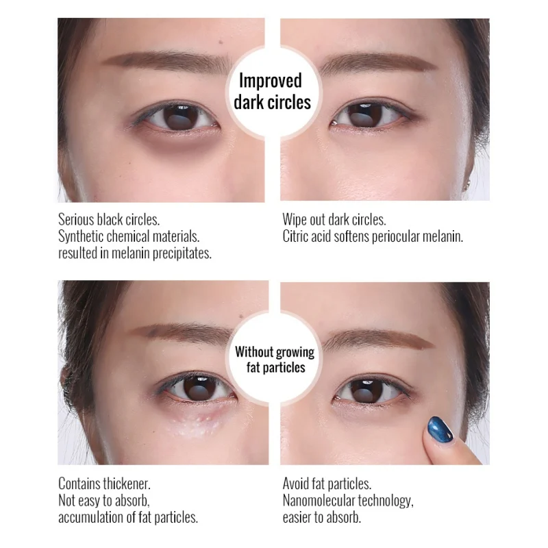 Snail Single Ageless Eye Skin Care Cream Wrinkle-reducing Remove Circles Beauty Firming Whitening Moisture Hydra Eye Cream
Snail Single Ageless Eye Skin Care Cream Wrinkle-reducing Remove Circles Beauty Firming Whitening Moisture Hydra Eye Cream