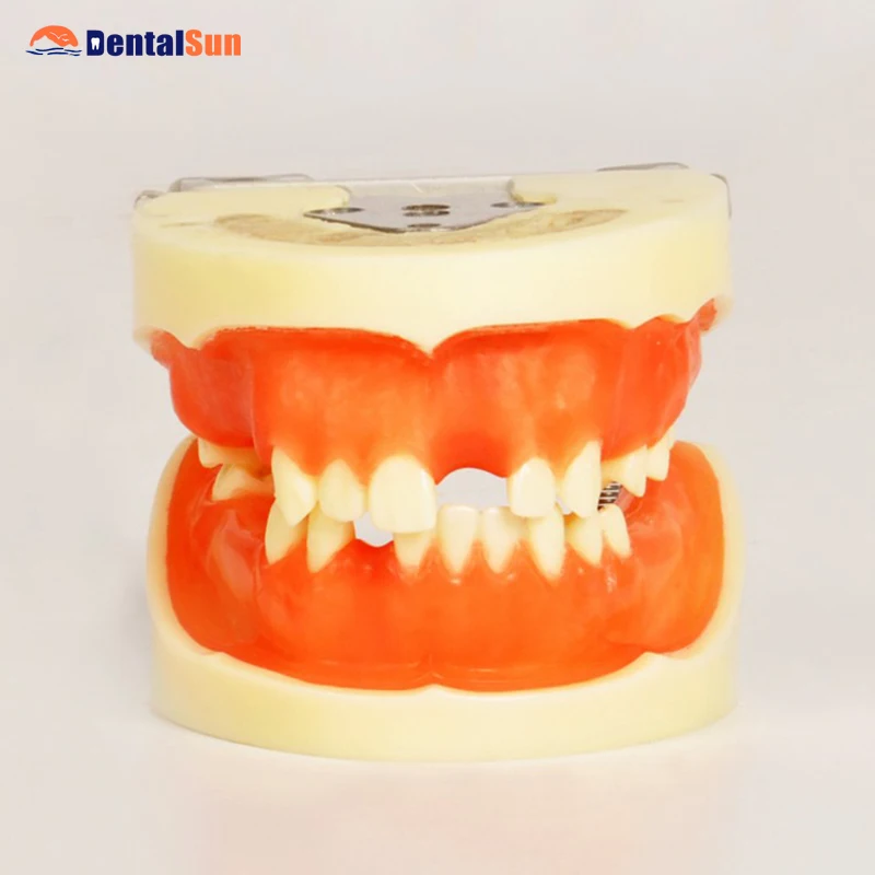 Dental M2002 Implant Practice Tooth Model for Dental Students with Soft Gum Can Practice Incision and Suturing
Dental M2002 Implant Practice Tooth Model for Dental Students with Soft Gum Can Practice Incision and Suturing