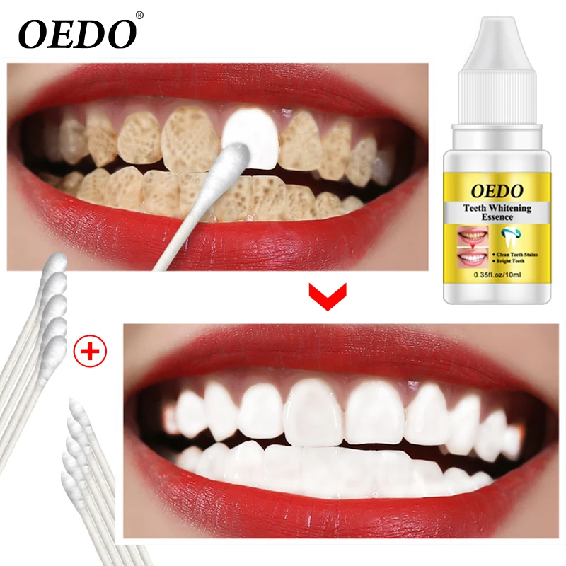 1pcs Teeth Whitening Essence Oral Hygiene Cleaning Water Serum Remove Stains Dental Teeth Whitening Tools Tooth Care
1pcs Teeth Whitening Essence Oral Hygiene Cleaning Water Serum Remove Stains Dental Teeth Whitening Tools Tooth Care