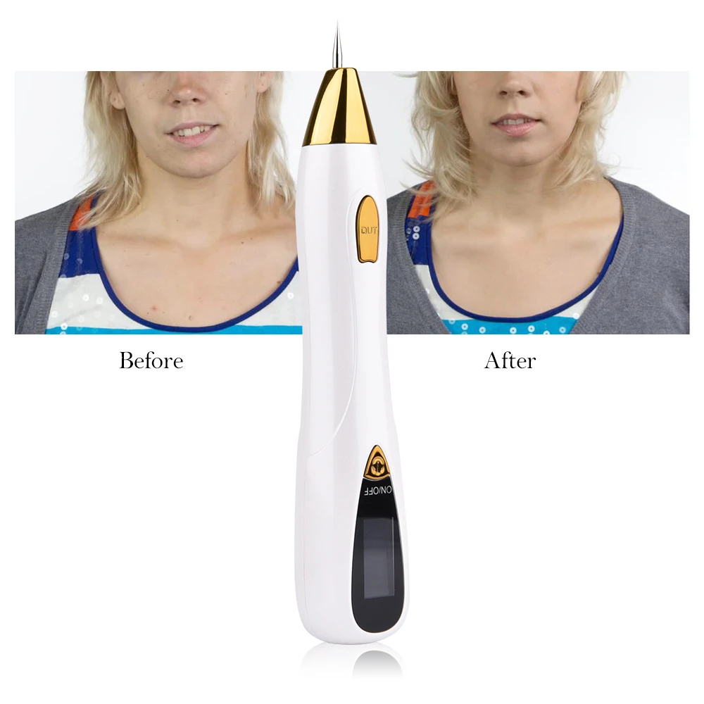 Laser Pen for Freckle Removal Skin Tag Removal Machine Dark Spot Wart Mole Remover Pen Face Tool Skin Care Machine Dropshipping
Laser Pen for Freckle Removal Skin Tag Removal Machine Dark Spot Wart Mole Remover Pen Face Tool Skin Care Machine Dropshipping