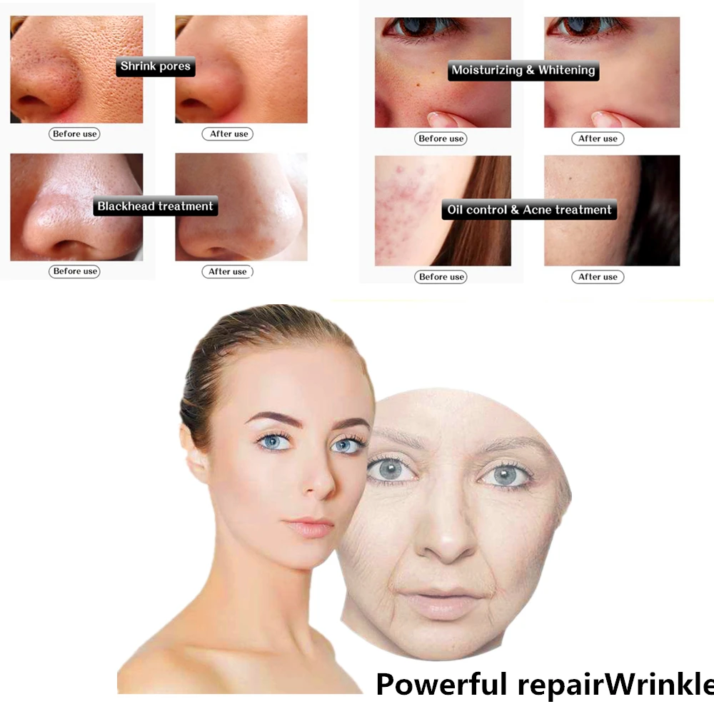 DISAAR Hyaluronic Acid Facial Day Cream Deep Moisturizing Whitening Filling Water Anti Wrinkle Lift Firming Esseence Skin Care
DISAAR Hyaluronic Acid Facial Day Cream Deep Moisturizing Whitening Filling Water Anti Wrinkle Lift Firming Esseence Skin Care