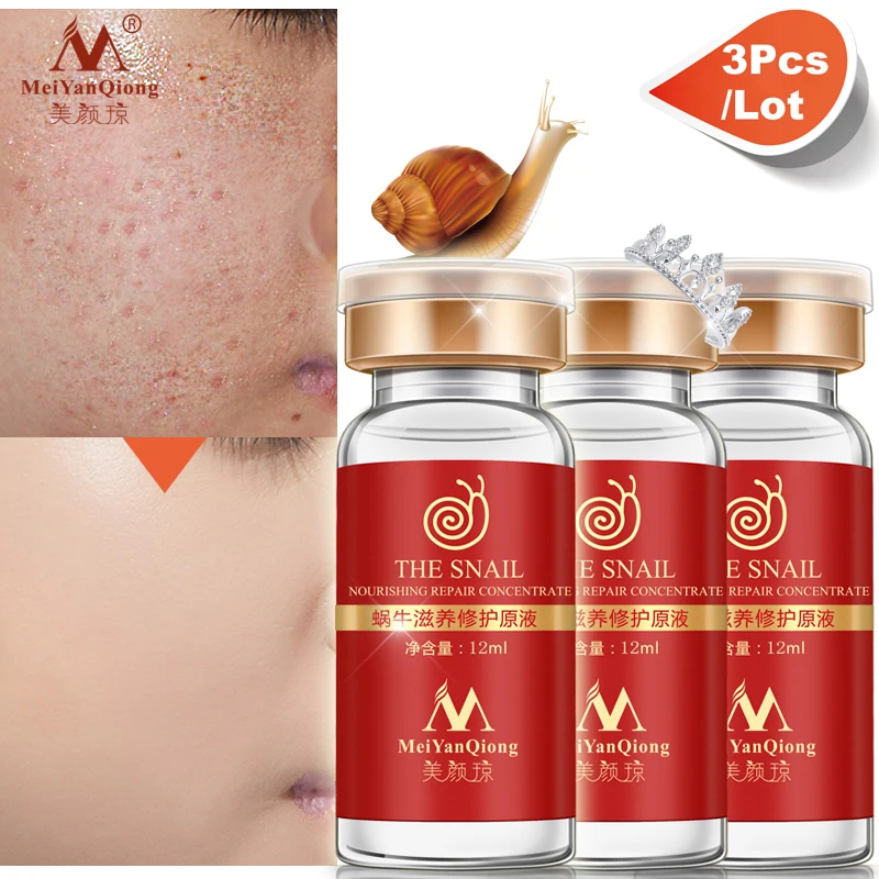 High Quality Snail 100% pure plant extract Hyaluronic acid liquid whitening blemish serum ampoules anti-acne Rejuvenation Serum
High Quality Snail 100% pure plant extract Hyaluronic acid liquid whitening blemish serum ampoules anti-acne Rejuvenation Serum