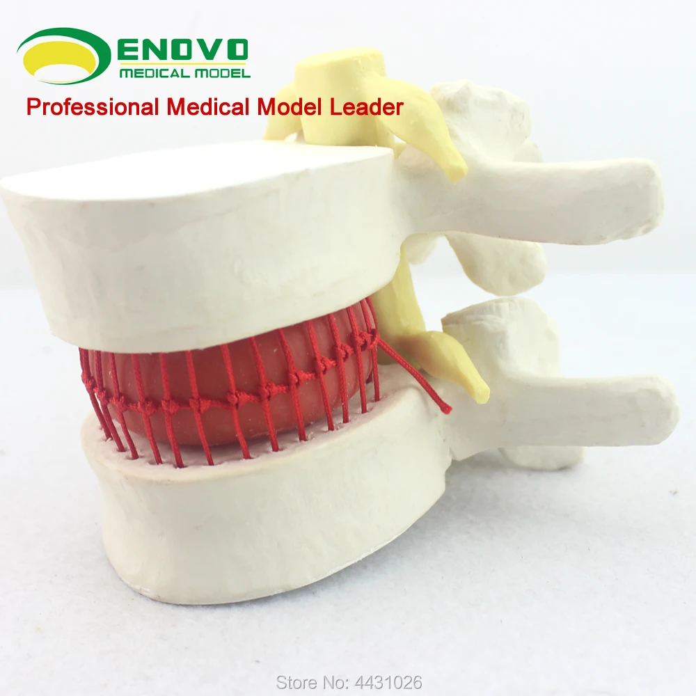 ENOVO The spine model of spinal nerve model was demonstrated in the medical human body lumbar disc
ENOVO The spine model of spinal nerve model was demonstrated in the medical human body lumbar disc