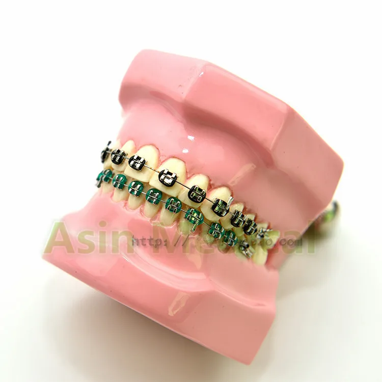 New Arrival Orthodontic correction model Dental Teaching model free shipping DEASIN
New Arrival Orthodontic correction model Dental Teaching model free shipping DEASIN
