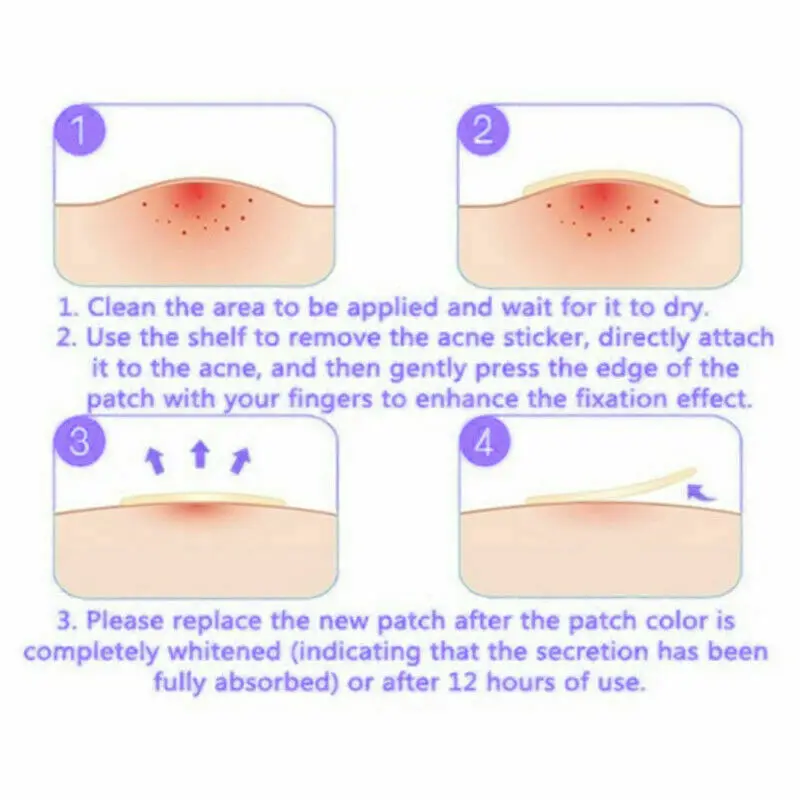 72PCS Skin Tag Acne Patch NEW Hydrocolloid Acne and Skin Tag Remover Patches USA
72PCS Skin Tag Acne Patch NEW Hydrocolloid Acne and Skin Tag Remover Patches USA