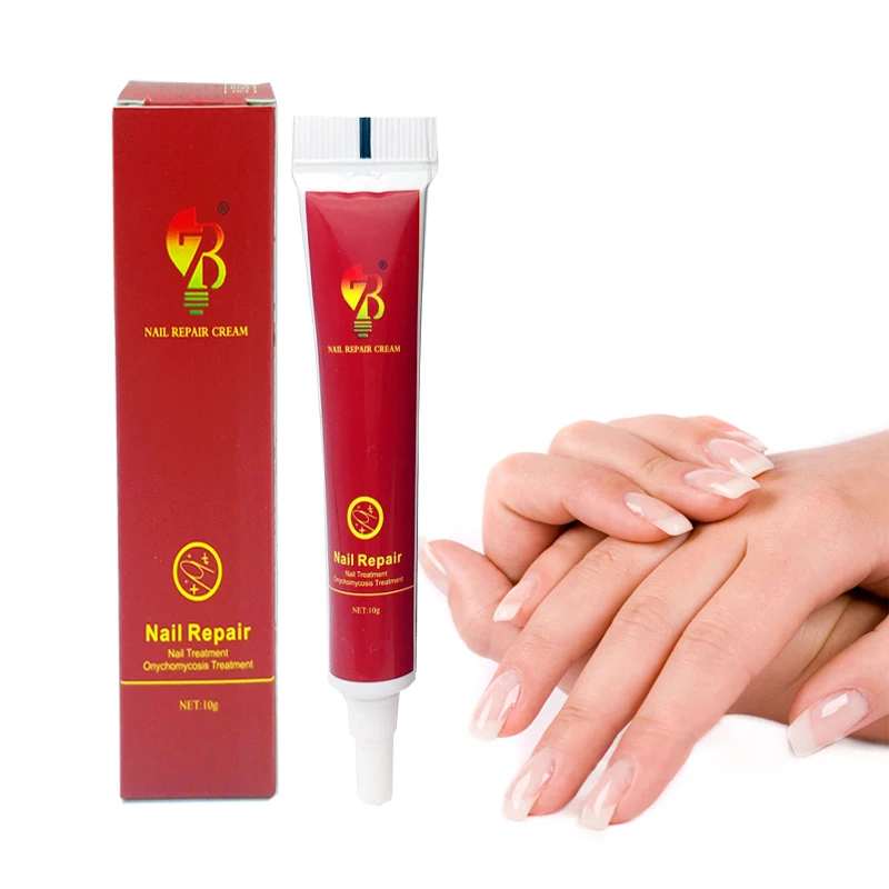 Chinese Medicine Plaster Nail Treatment Cream Onychomycosis Anti Nail Infection Fights Bacteria Naturally Ointment
Chinese Medicine Plaster Nail Treatment Cream Onychomycosis Anti Nail Infection Fights Bacteria Naturally Ointment