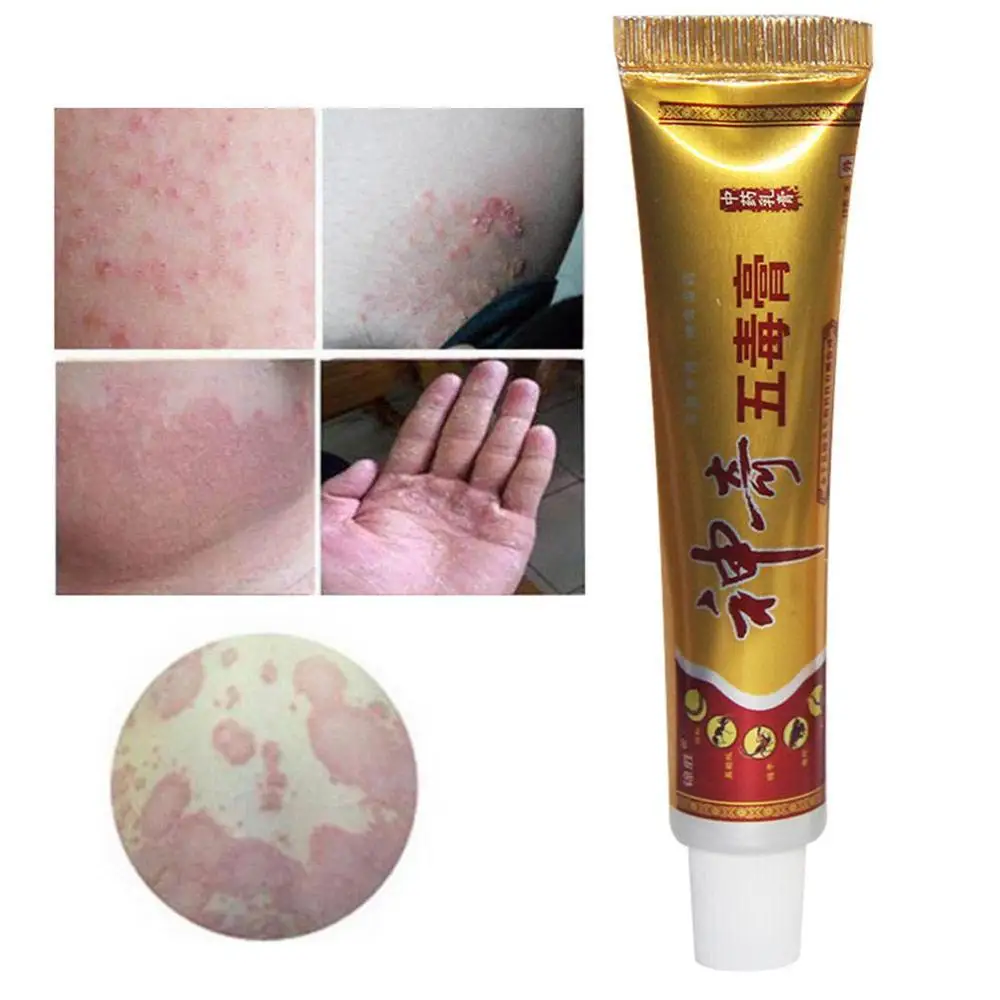10pcs Herbal Psoriasis Pruritus Cream Dermatitis Eczematoid Eczema Ointment Treatment Psoriasis Cream Skin Care Cream 15g
10pcs Herbal Psoriasis Pruritus Cream Dermatitis Eczematoid Eczema Ointment Treatment Psoriasis Cream Skin Care Cream 15g