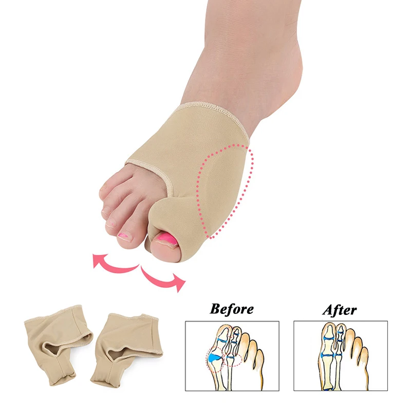 1 пара Bunion Sleeves Hallux корректор вальгусной деформации-выпрямитель разделитель носка плюсневая шина ортопедические средства для облегчения бо...
1 пара Bunion Sleeves Hallux корректор вальгусной деформации-выпрямитель разделитель носка плюсневая шина ортопедические средства для облегчения бо...
