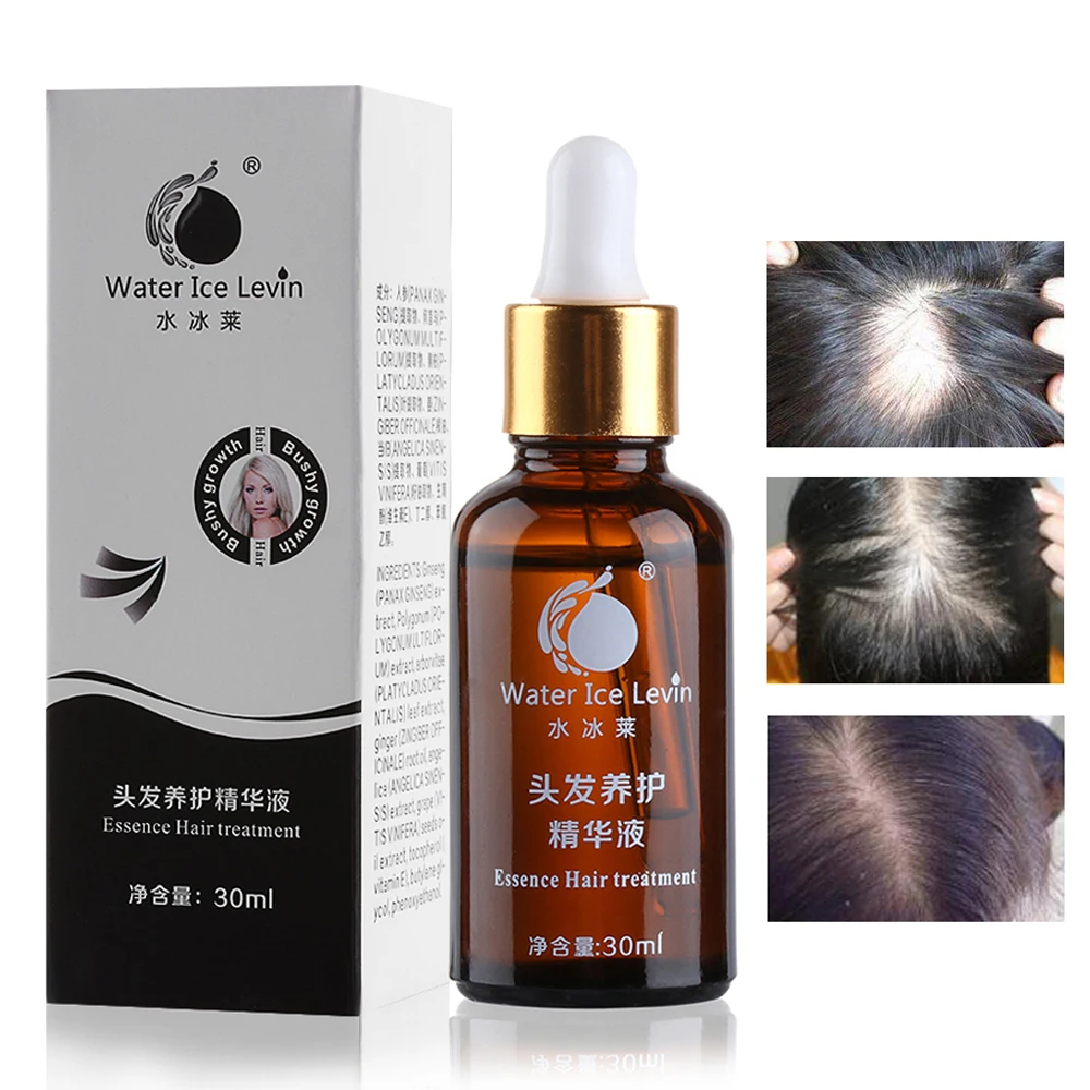 Hair Growth Oil Hair Loss Prevention Treatment For Men Women With Thinning Hair Blocker For Receding Hairline & Pattern Baldness
Hair Growth Oil Hair Loss Prevention Treatment For Men Women With Thinning Hair Blocker For Receding Hairline & Pattern Baldness