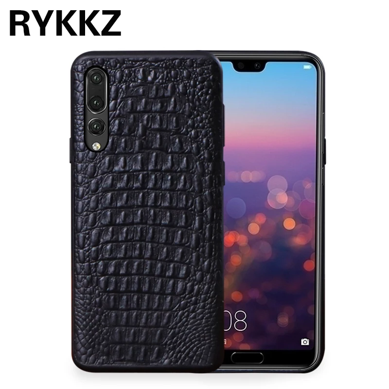 RYKKZ For HUAWEI P20 Pro Case Genuine Leather Phone Protective Back Cover For Huawei P20 P20 Pro Mobile Phone Case
RYKKZ For HUAWEI P20 Pro Case Genuine Leather Phone Protective Back Cover For Huawei P20 P20 Pro Mobile Phone Case