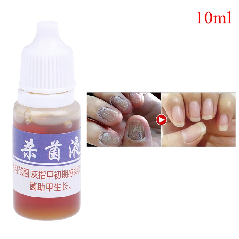 1Pc Essence Foot Whitening Toenail Fungus Removal Anti Infection Paronychia Onychomycosis Useful Fungal Nail Treatment Feet Care
1Pc Essence Foot Whitening Toenail Fungus Removal Anti Infection Paronychia Onychomycosis Useful Fungal Nail Treatment Feet Care