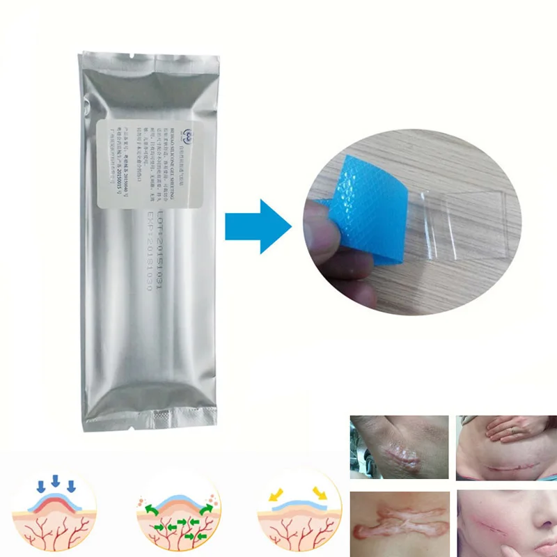Silicone Removal Patch Reusable Acne Gel Scar Therapy Silicon Patch Remove Trauma Burn Sheet Skin Repair
Silicone Removal Patch Reusable Acne Gel Scar Therapy Silicon Patch Remove Trauma Burn Sheet Skin Repair