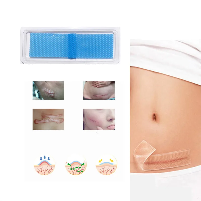 1pcs/bag Scar Removing Patch Scar Therapy Patch dilute medical gel silicone scar removal palster
1pcs/bag Scar Removing Patch Scar Therapy Patch dilute medical gel silicone scar removal palster