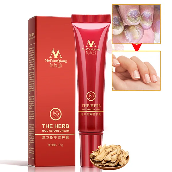 1 pc Natural Herb Nails Repair Cream Nail Foot Protector Skin Care Cream Nail Fungus Treatment Herb Nail Care Tools
1 pc Natural Herb Nails Repair Cream Nail Foot Protector Skin Care Cream Nail Fungus Treatment Herb Nail Care Tools