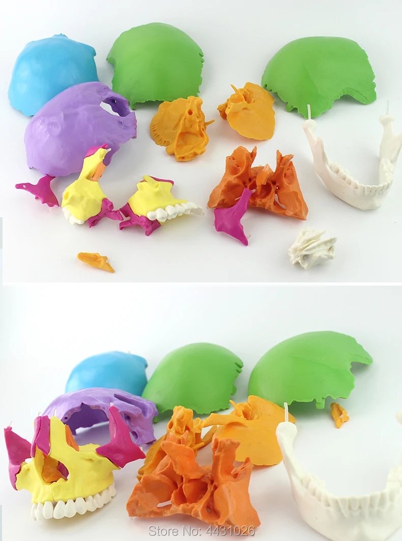 ENOVO Medical human.skull model micro plastic surgery department of Stomatology skull 22 parts can be removed
ENOVO Medical human.skull model micro plastic surgery department of Stomatology skull 22 parts can be removed