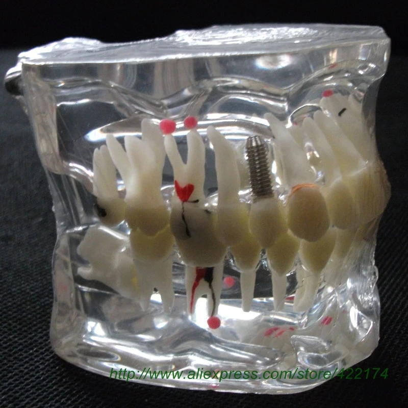 Модель анатомической анатомии зубов для взрослых бесплатная доставка|anatomy model|model