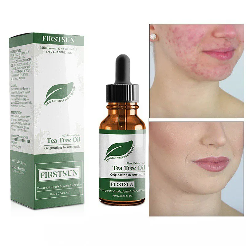 Natural Tea Tree Massage Oil Moisturizing Oil-Control Desalination Balance Shrinkage Pore Repair Essential Oil 2019
Natural Tea Tree Massage Oil Moisturizing Oil-Control Desalination Balance Shrinkage Pore Repair Essential Oil 2019