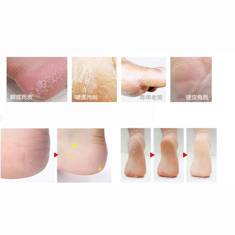 10 pcs / set.Foot Set Dead File Scraper Hard Callus Remover Cuticle Pusher Pedicure Rasp Portable Tools Nail Care With Feet Tool
10 pcs / set.Foot Set Dead File Scraper Hard Callus Remover Cuticle Pusher Pedicure Rasp Portable Tools Nail Care With Feet Tool